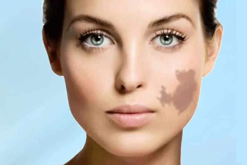 Skin Clinic