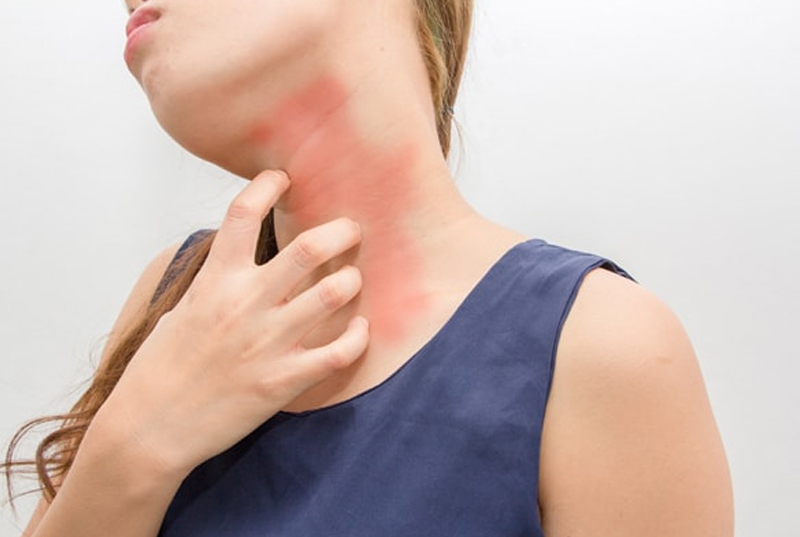 Skin Allergy