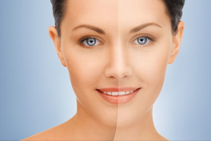 Skin Brightening